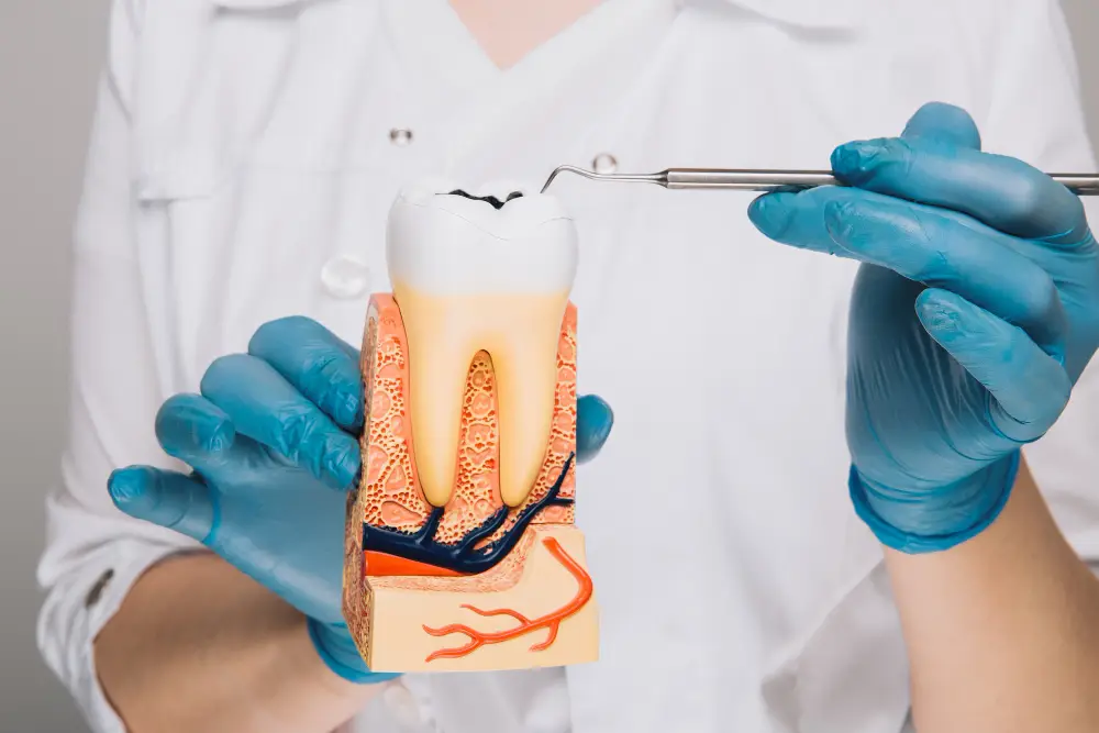 Endodoncia