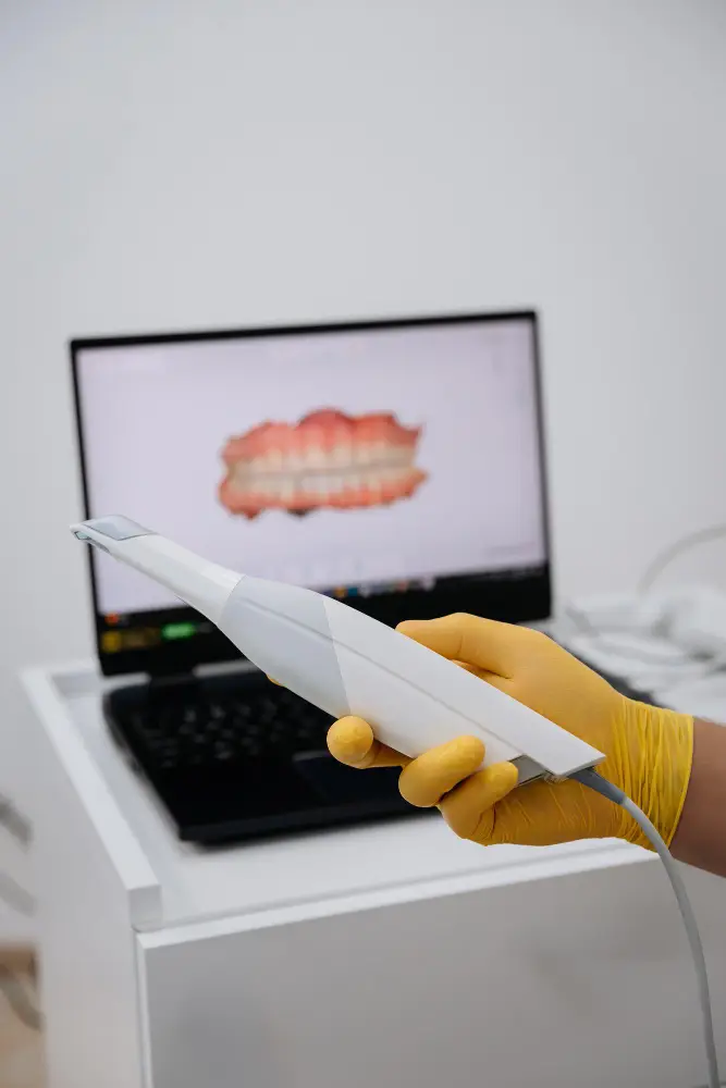 Escáner intraoral en clínica dental