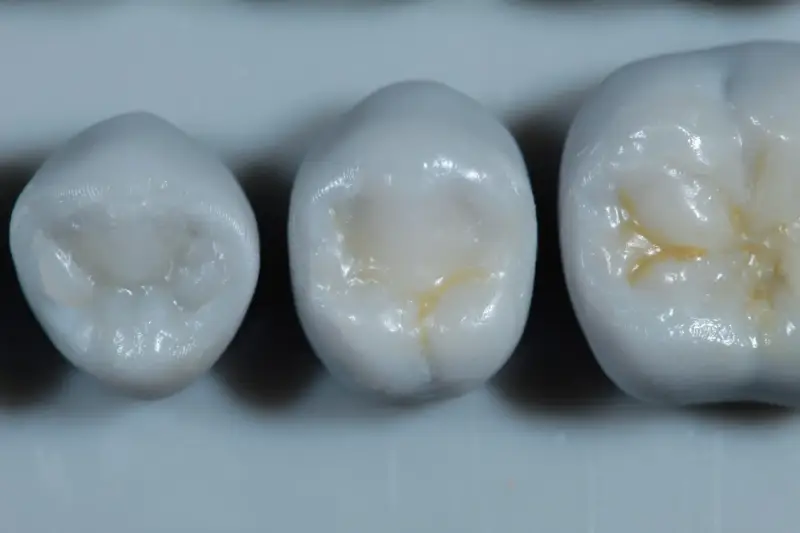 Resinas dentales