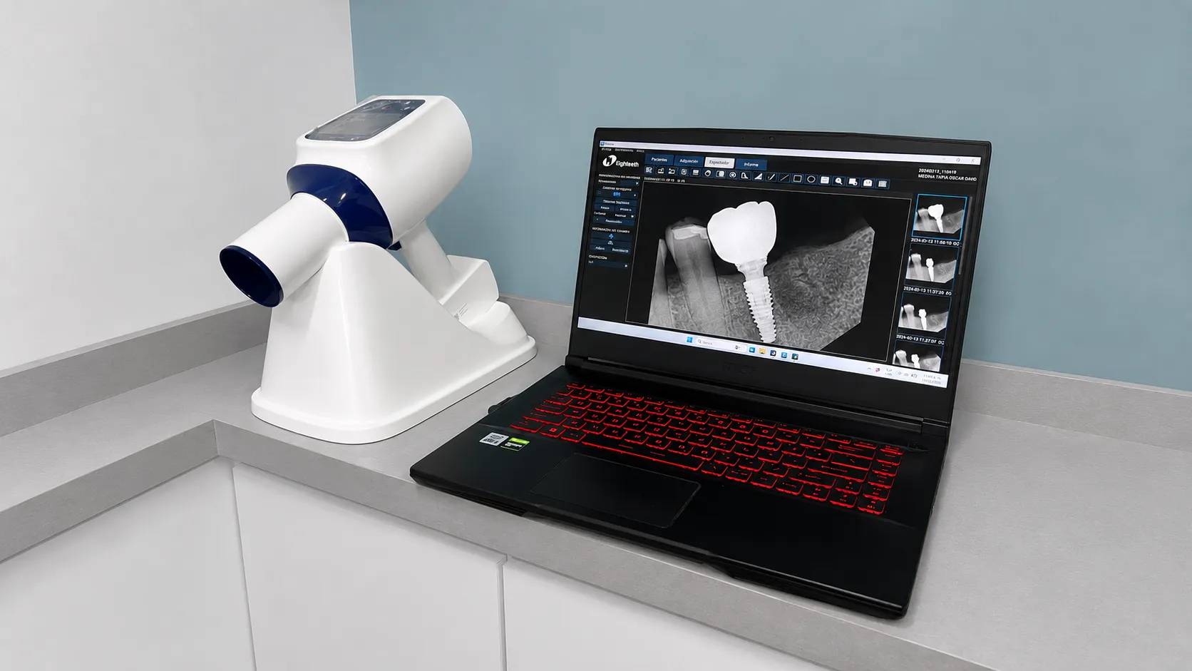 Equipo de radiografía digital dental